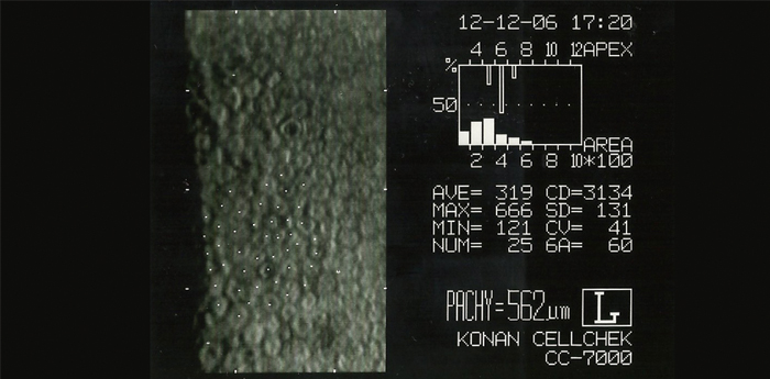 LA IMPORTANCIA CLÍNICA DE LA MICROSCOPÍA ESPECULAR
