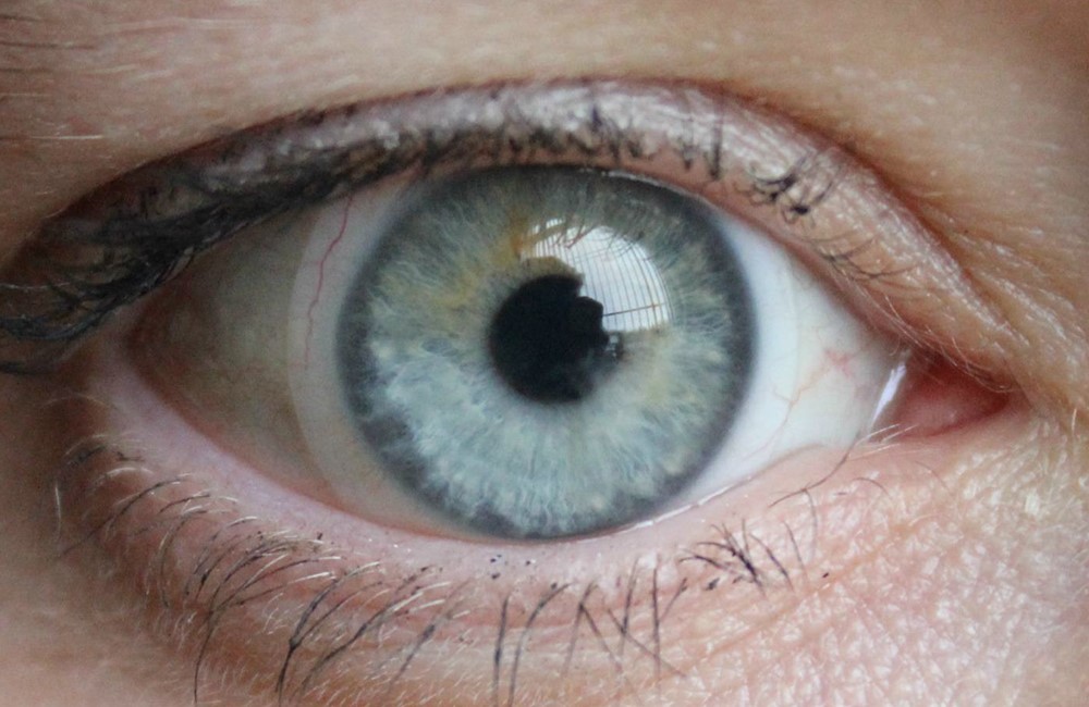 Es tiempo de lentes de contacto tóricos