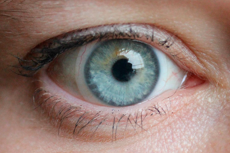 Lentes de contacto con curvas periféricas tóricas