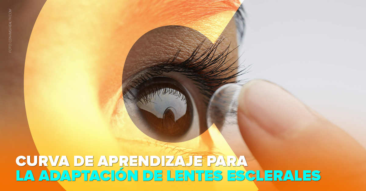 CURVA DE APRENDIZAJE EN LA ADAPTACIÓN DE LENTES ESCLERALES