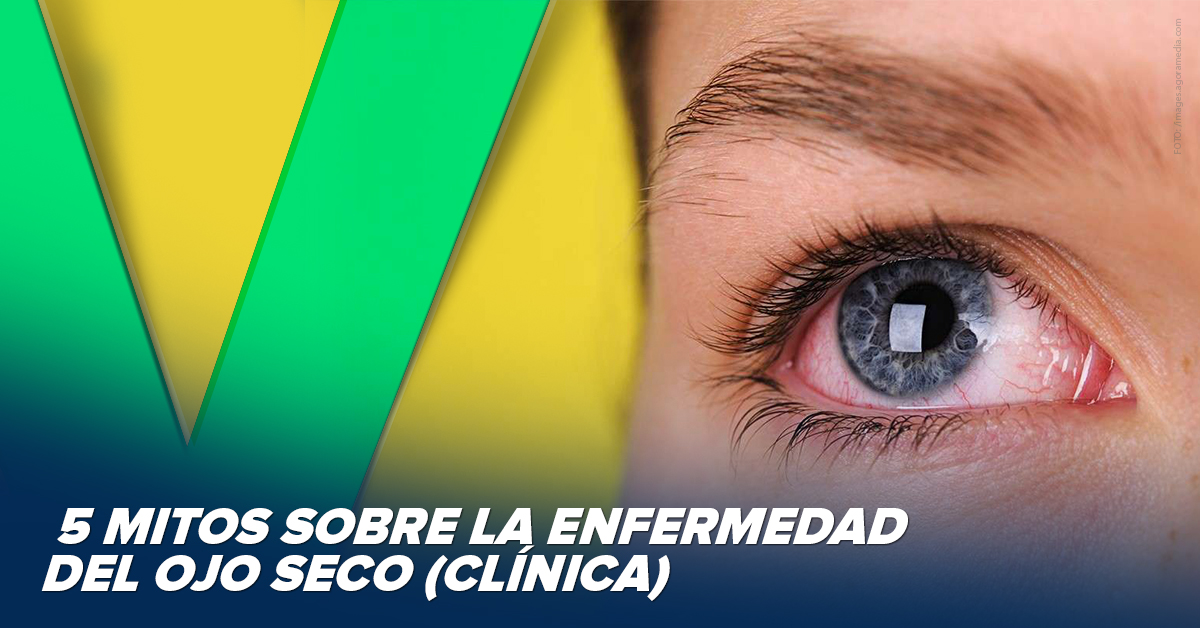 Cinco mitos sobre la enfermedad del ojo seco