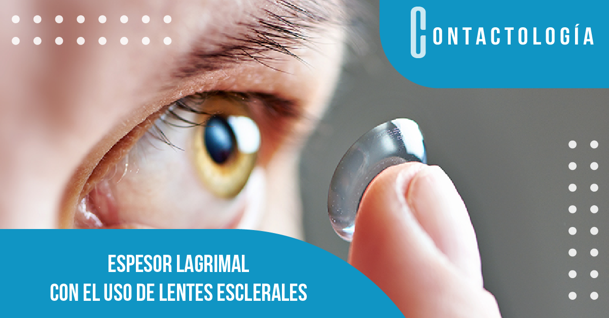 ESPESOR LAGRIMAL CON USO DE LENTES ESCLERALES
