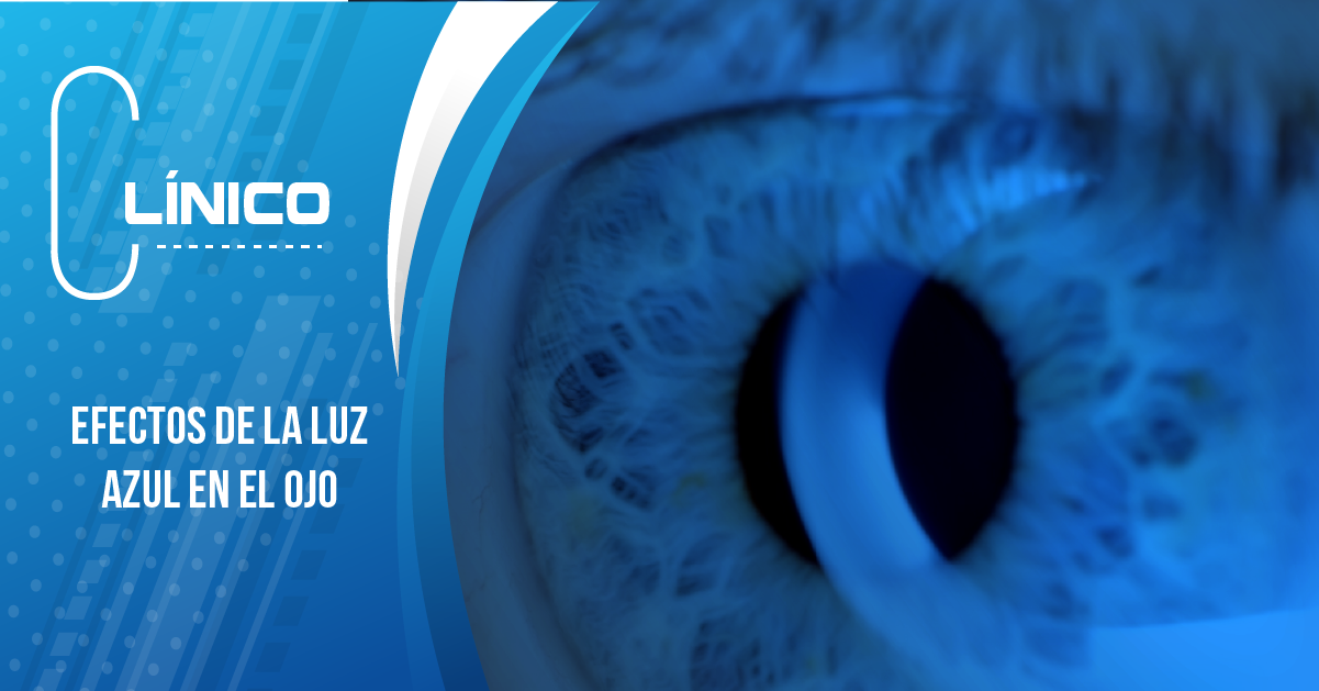 EFECTOS DE LA LUZ AZUL EN EL OJO