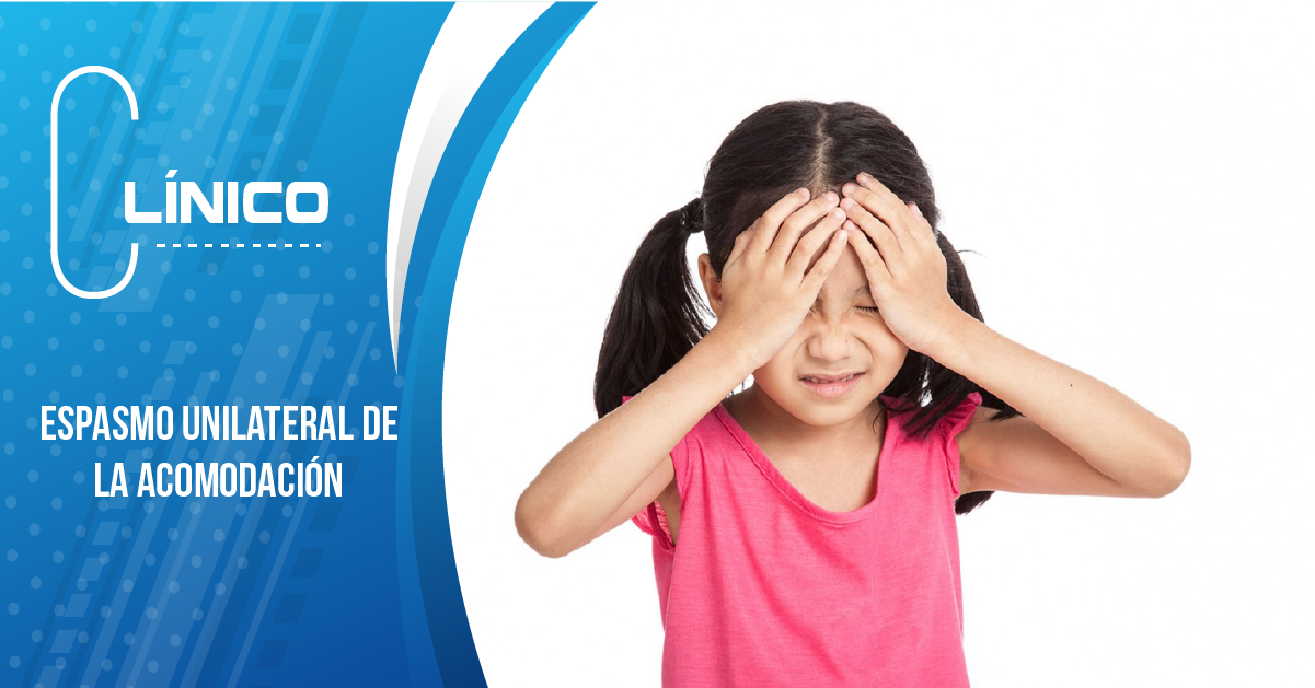 ESPASMO UNILATERAL DE LA ACOMODACIÓN