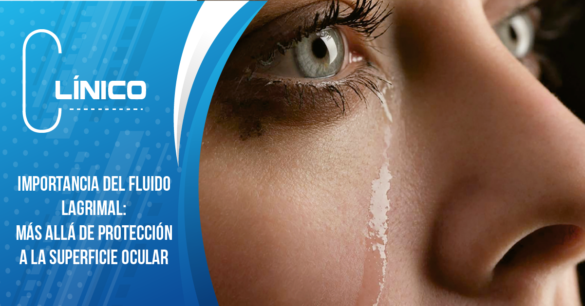 IMPORTANCIA DEL FLUIDO LAGRIMAL: Más allá de protección a la superficie ocular