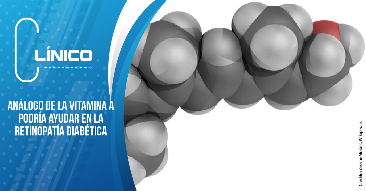 ANÁLOGO DE LA VITAMINA A PODRÍA AYUDAR EN LA RETINOPATÍA DIABÉTICA