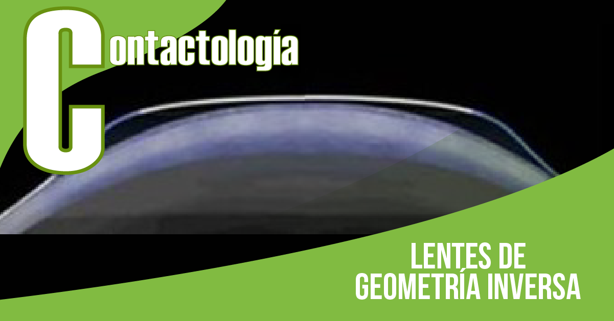 LENTES DE GEOMETRÍA INVERSA