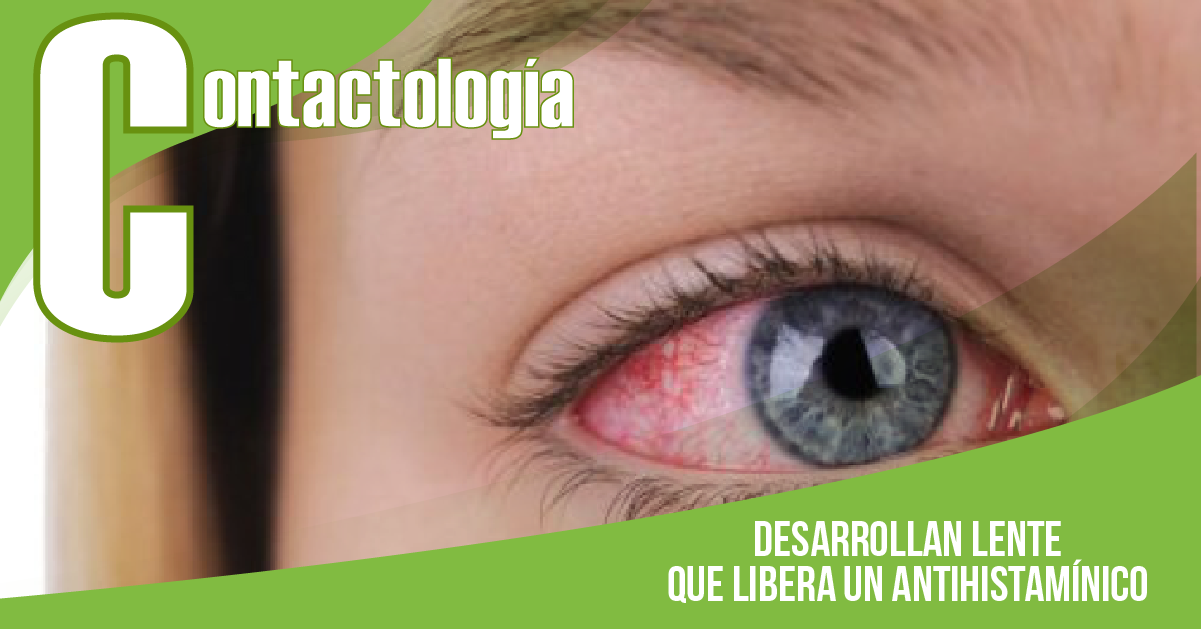 DESARROLLAN LENTE QUE LIBERA UN ANTIHISTAMÍNICO