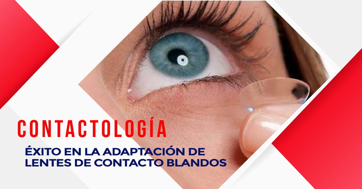 ÉXITO EN LA ADAPTACIÓN DE LENTES DE CONTACTO BLANDOS