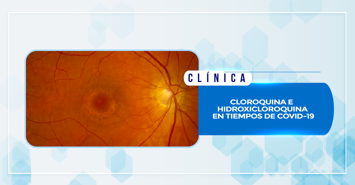 CLOROQUINA E HIDROXICLOROQUINA EN TIEMPOS DE COVID-19