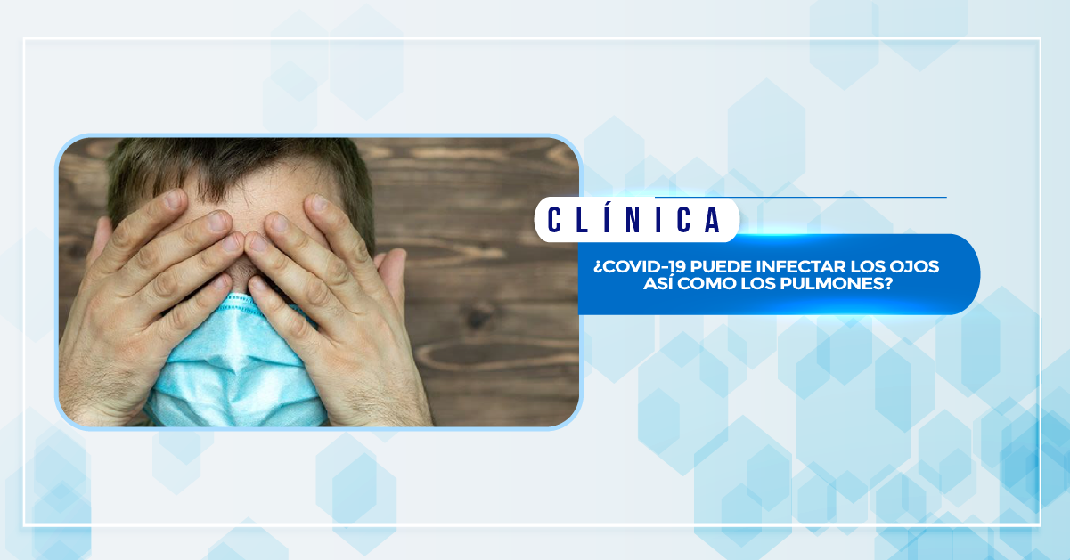 ¿COVID-19 PUEDE INFECTAR LOS OJOS ASÍ COMO LOS PULMONES?