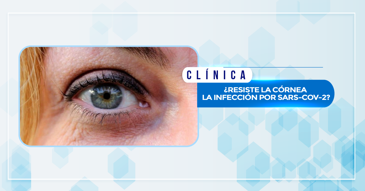 ¿RESISTE LA CÓRNEA LA INFECCIÓN POR SARS-COV-2?