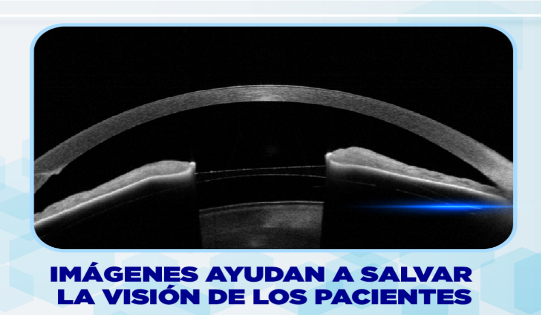 IMÁGENES AYUDAN A SALVAR LA VISIÓN DE LOS PACIENTES