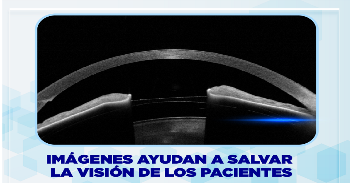 IMÁGENES AYUDAN A SALVAR LA VISIÓN DE LOS PACIENTES