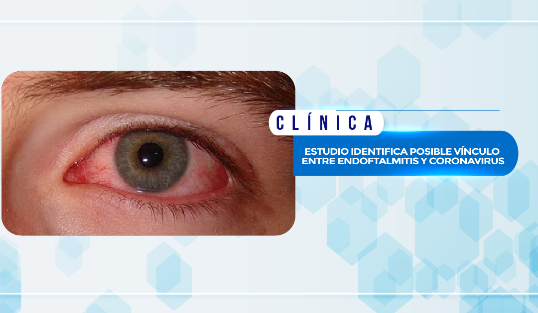ESTUDIO IDENTIFICA POSIBLE VÍNCULO ENTRE ENDOFTALMITIS Y CORONAVIRUS