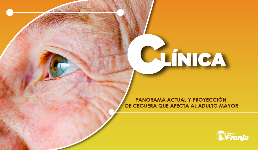 PANORAMA ACTUAL Y PROYECCIÓN DE CEGUERA QUE AFECTA AL ADULTO MAYOR