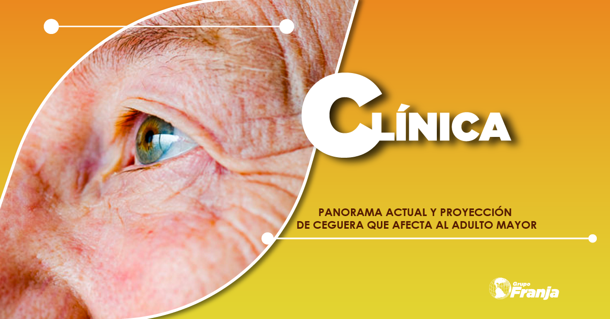 PANORAMA ACTUAL Y PROYECCIÓN DE CEGUERA QUE AFECTA AL ADULTO MAYOR