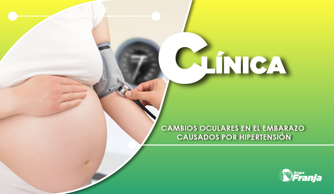 CAMBIOS OCULARES EN EL EMBARAZO CAUSADOS POR HIPERTENSIÓN