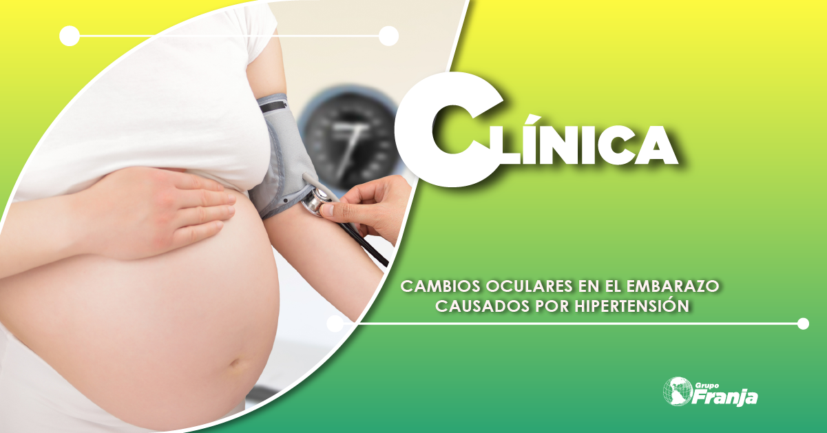 CAMBIOS OCULARES EN EL EMBARAZO CAUSADOS POR HIPERTENSIÓN