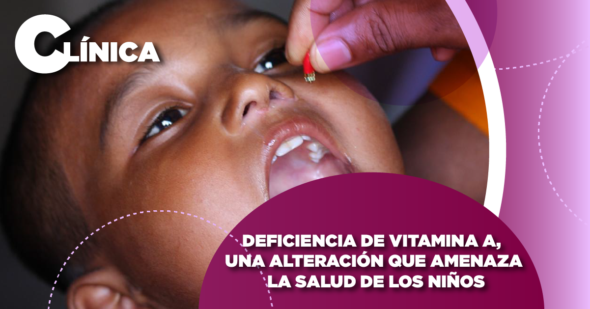 DEFICIENCIA DE VITAMINA A, UNA ALTERACIÓN QUE AMENAZA LA SALUD DE LOS NIÑOS