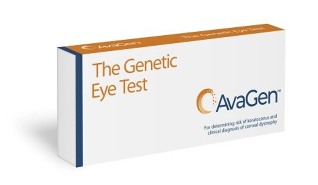 PRUEBA GENÉTICA PARA CUANTIFICAR EL RIESGO DE QUERATOCONO Y LA PRESENCIA DE DISTROFIAS CORNEALES