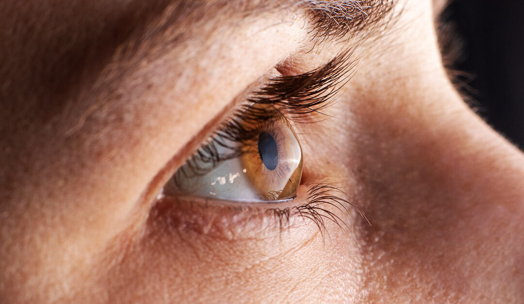 MANEJO DEL QUERATOCONO