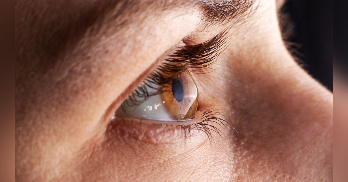 MANEJO DEL QUERATOCONO