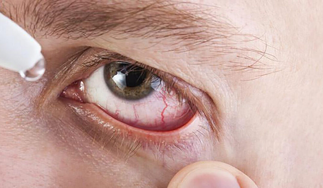 EL SUSTITUTO LAGRIMAL IDEAL PARA LA ENFERMEDAD DE OJO SECO