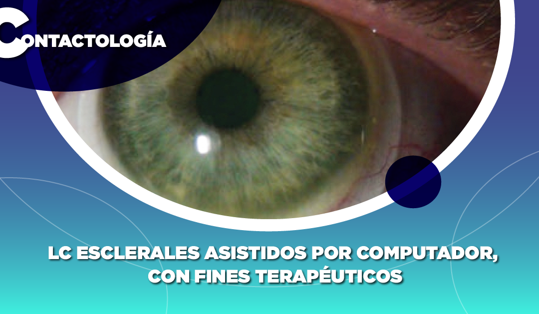 LC ESCLERALES ASISTIDOS POR COMPUTADOR, CON FINES TERAPÉUTICOS