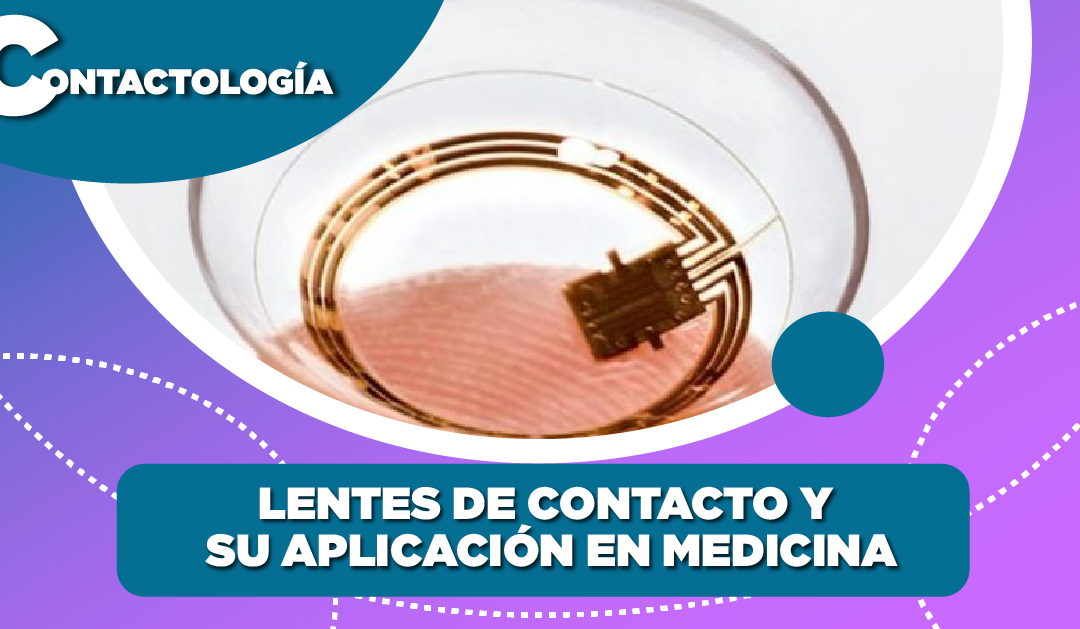 Lentes de contacto y su aplicación en medicina