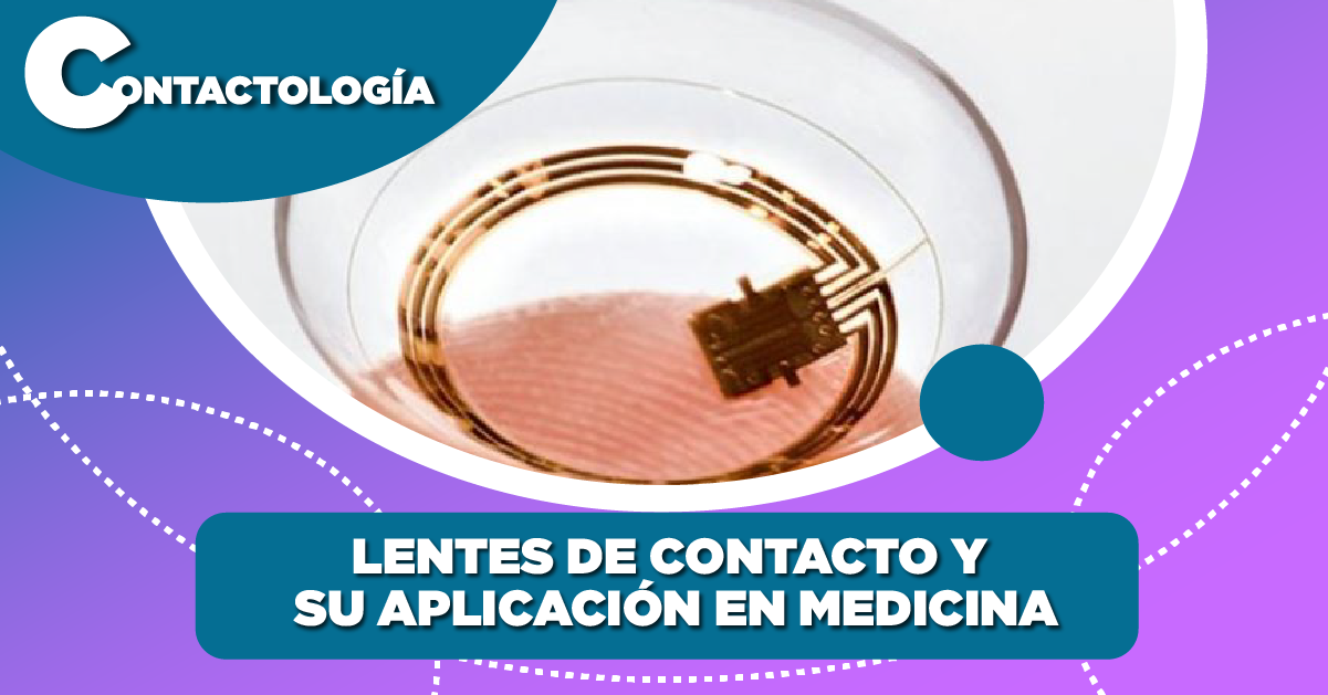 Lentes de contacto y su aplicación en medicina