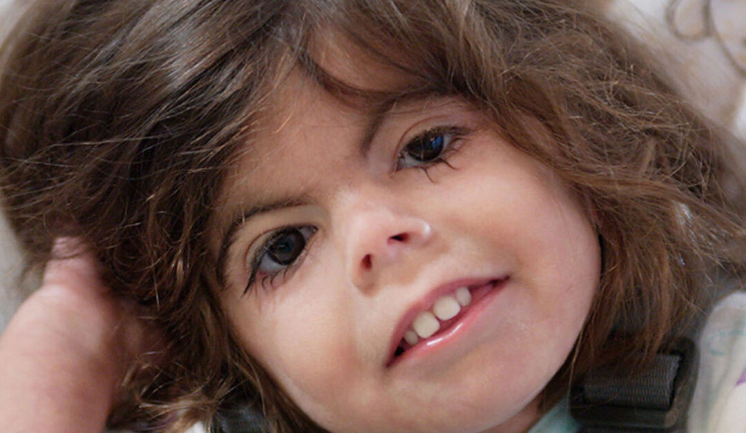 Perspectiva pediátrica del síndrome Cornelia de Lange