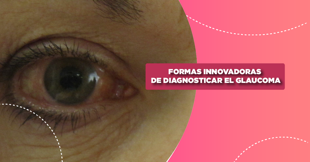 Formas Innovadoras de Diagnosticar el Glaucoma