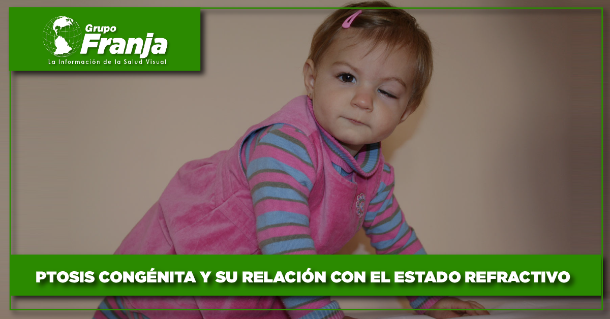 Ptosis congénita y su relación con el estado refractivo