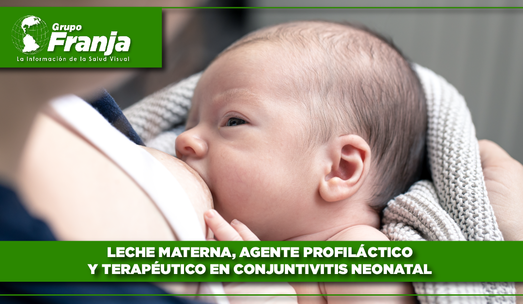 Leche materna, agente profiláctico y terapéutico en conjuntivitis neonatal