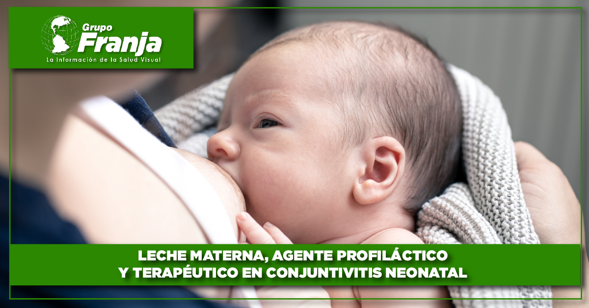 Leche materna, agente profiláctico y terapéutico en conjuntivitis neonatal