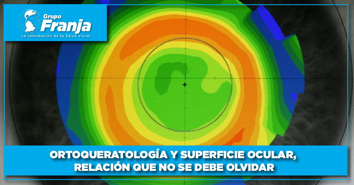 Ortoqueratología y superficie ocular, relación que no se debe olvidar