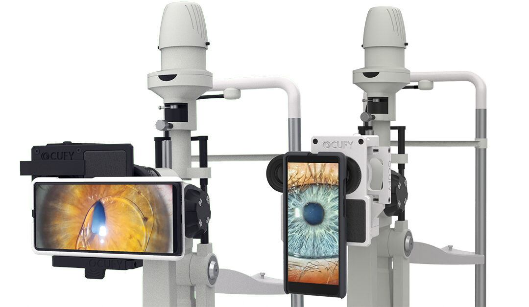 Dispositivos para digitalización de lámparas de hendidura