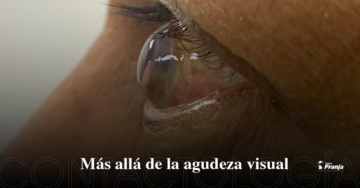 Más allá de la agudeza visual