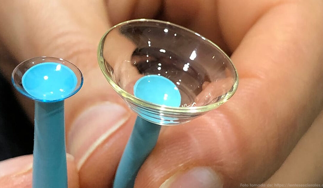 El lente escleral frente a obstáculos conjuntivales