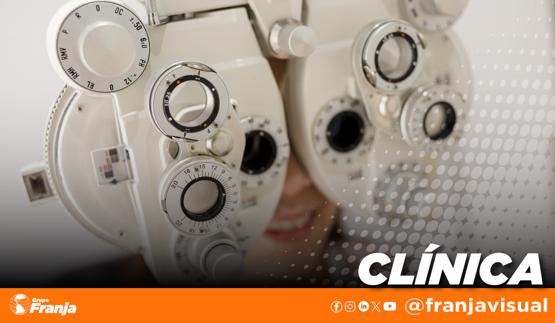 Si le doy todo el valor positivo de la hipermetropía, puede ser que…