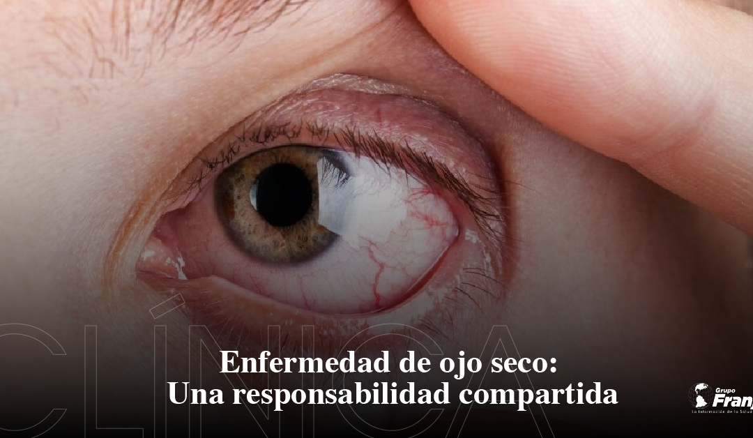 Enfermedad de ojo seco: Una responsabilidad compartida