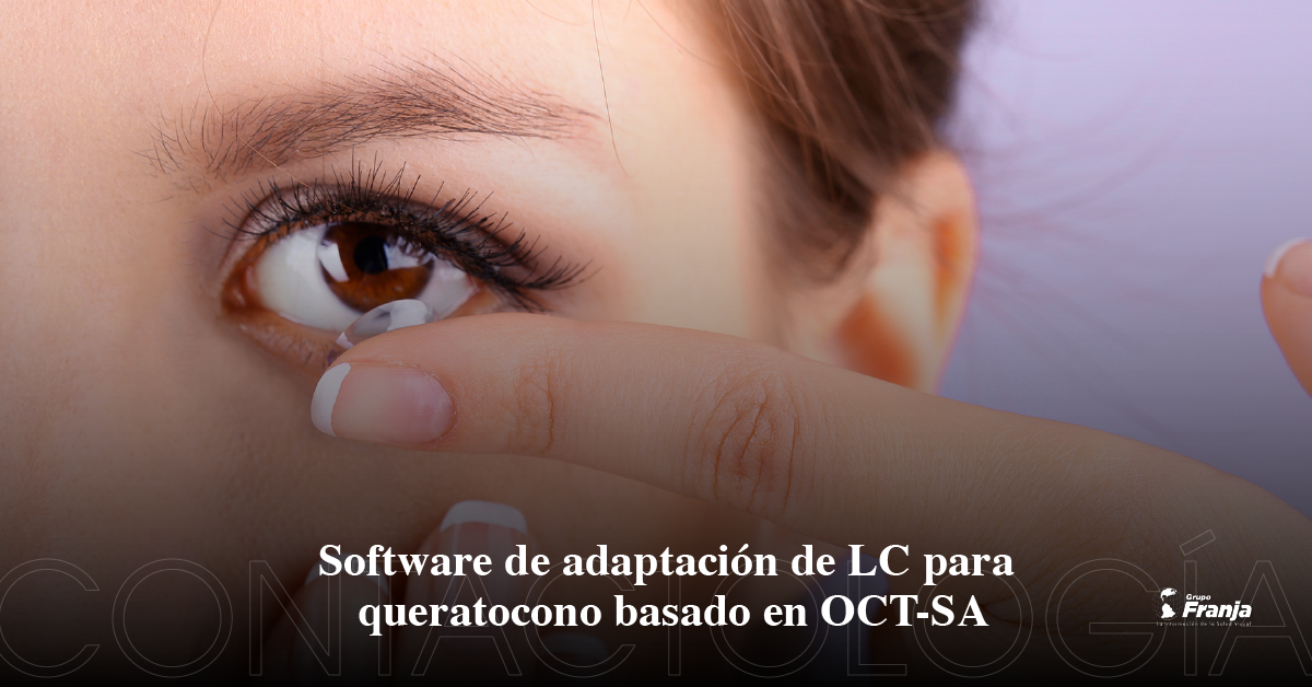 Software de adaptación de LC para queratocono basado en OCT-SA