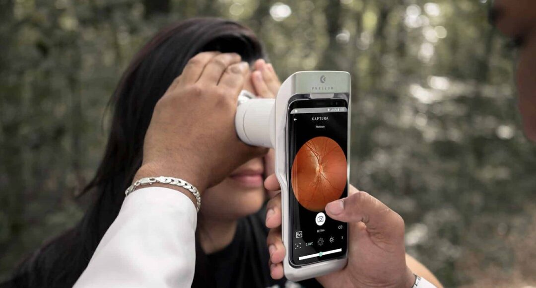 Cámara retinal portátil Eyer