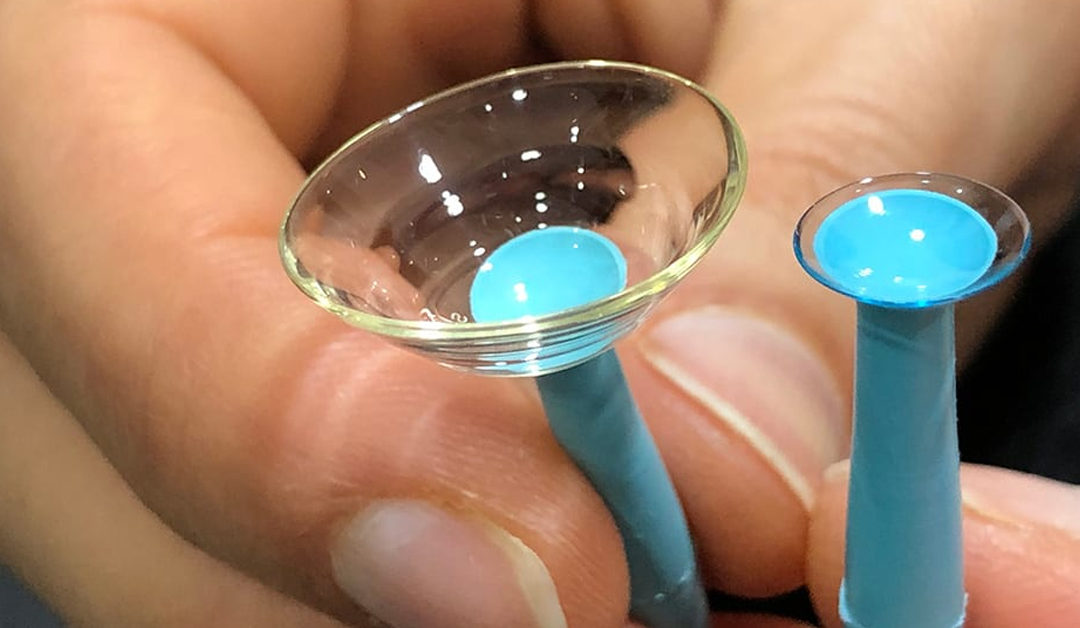 Seguridad y eficacia de los LC después de un trasplante simple de células epiteliales limbales