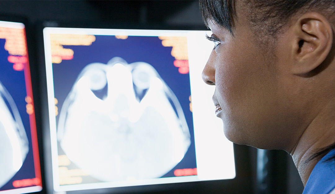 El ojo: entrada al diagnóstico de enfermedad neurodegenerativa