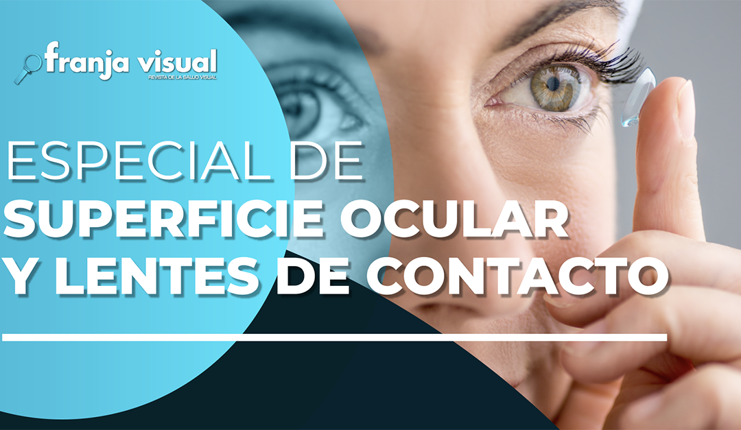 Superficie Ocular y Lentes de Contacto