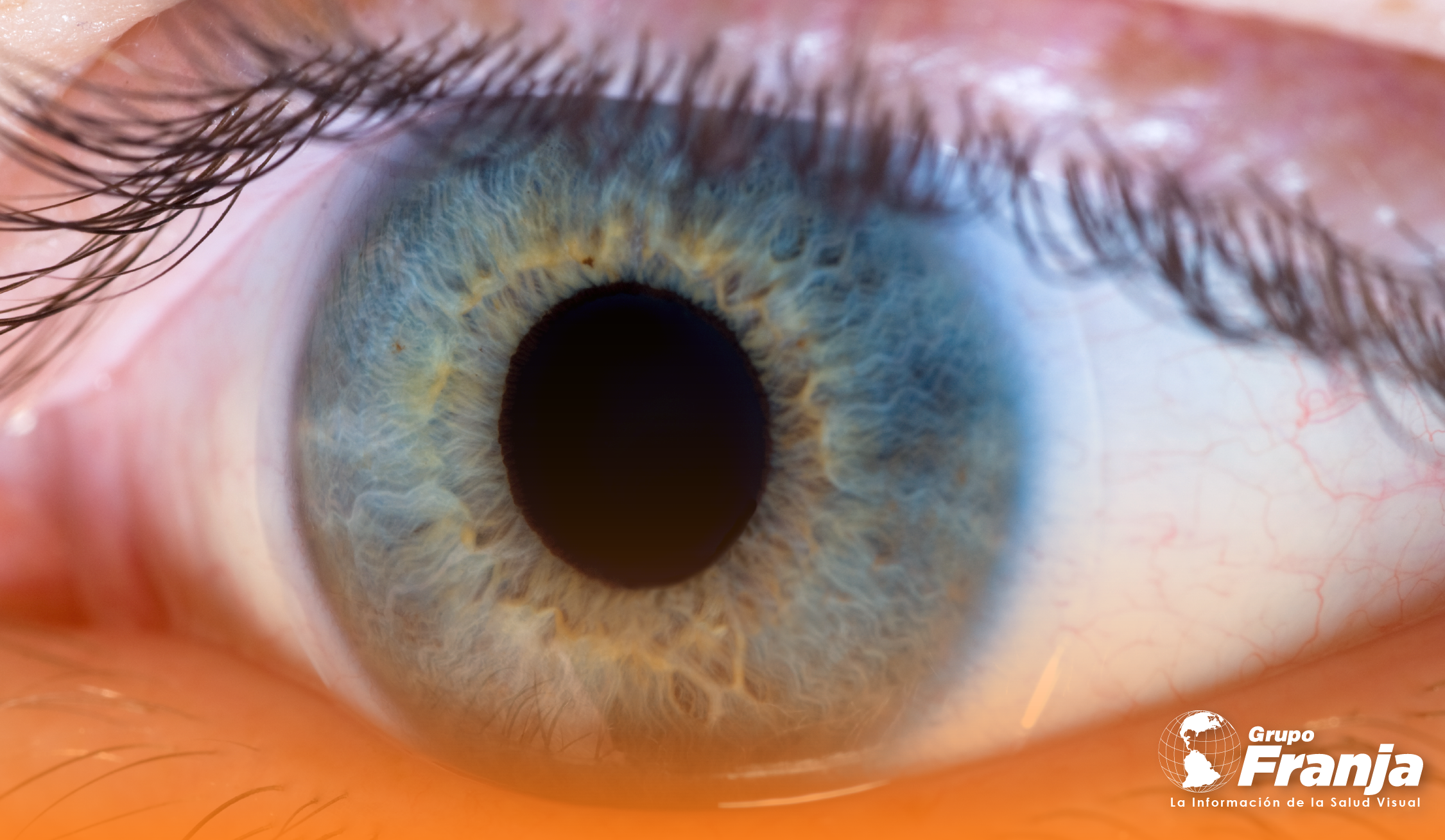 LC reutilizables vs LC diarios