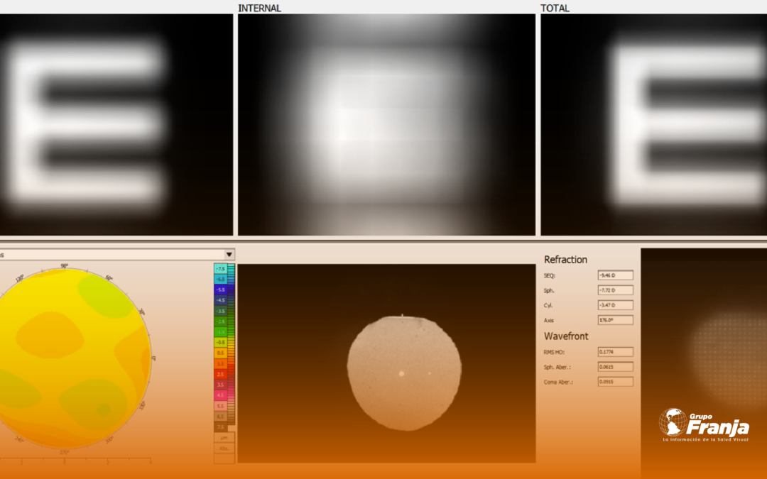 Principios básicos de aberrometría II parte Los polinomios de Zernike