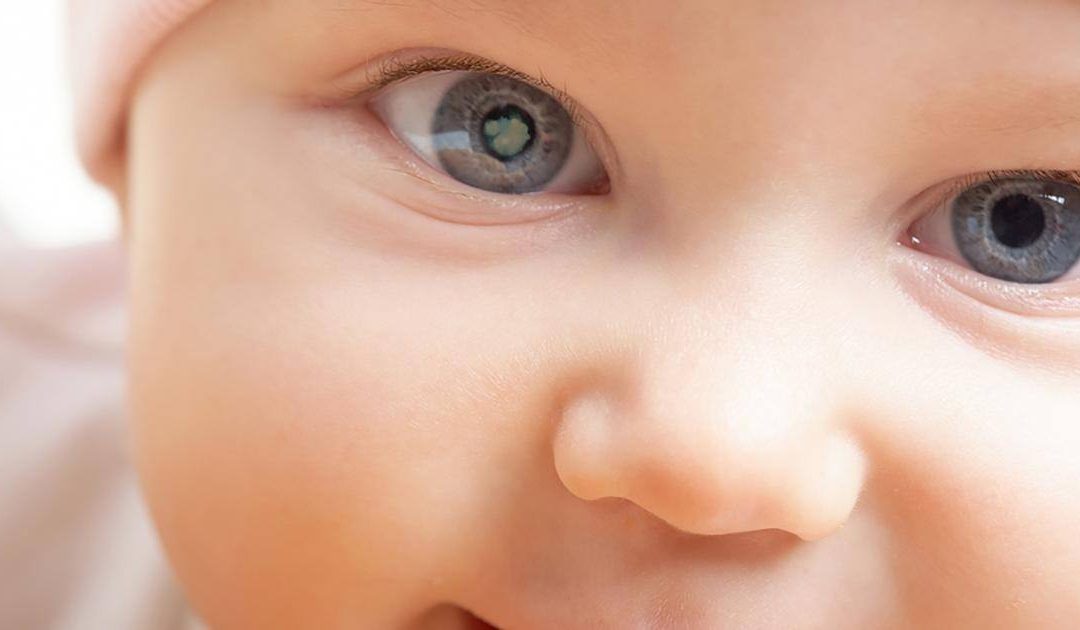 UN RECORRIDO RÁPIDO POR LA ETIOLOGÍA DE CATARATA PEDIÁTRICA